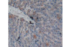 Used in DAB staining on fromalin fixed paraffin- embedded liver tissue (CPB2 anticorps  (AA 164-417))