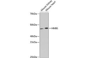 Western blot analysis of extracts of various cell lines, using HMBS Rabbit mAb (ABIN7267806) at 1:1000 dilution. (HMBS anticorps)