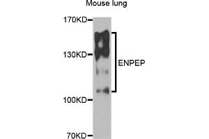 Western blot analysis of extracts of mouse lung, using ENPEP antibody.