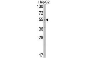 Western blot analysis of SLC38A3 Antibody (Center) in HepG2 cell line lysates (35ug/lane).