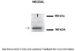 Human cystic fibrosis epithelial