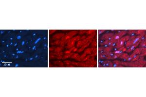 Rabbit Anti-VCP Antibody Catalog Number: ARP59365_P050 Formalin Fixed Paraffin Embedded Tissue: Human heart Tissue Observed Staining: Cytoplasmic, nucleus Primary Antibody Concentration: 1:100 Other Working Concentrations: N/A Secondary Antibody: Donkey anti-Rabbit-Cy3 Secondary Antibody Concentration: 1:200 Magnification: 20X Exposure Time: 0.