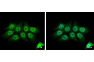 ICC/IF Image TMS1 antibody [N1C3] detects TMS1 protein at cytoplasm and nucleus by immunofluorescent analysis. (PYCARD anticorps)