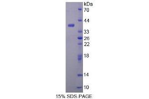 SDS-PAGE analysis of Mouse ALDH1A1 Protein. (ALDH1A1 Protéine)