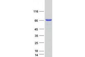 Validation with Western Blot