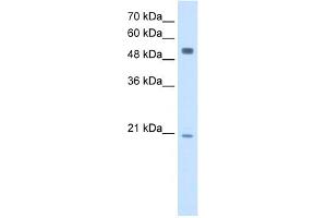 WB Suggested Anti-BLK Antibody Titration:  2. (BLK anticorps  (Middle Region))