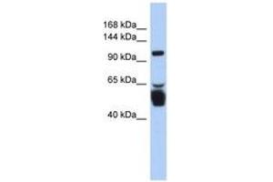 Image no. 1 for anti-Leucine Rich Repeat Containing 8 Family, Member B (LRRC8B) (AA 143-192) antibody (ABIN6743445)