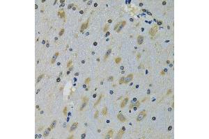 Immunohistochemistry of paraffin-embedded mouse brain using RPS12 antibody.