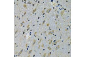 Immunohistochemistry of paraffin-embedded mouse brain using RPS12 antibody. (RPS12 anticorps  (AA 1-132))