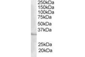 Image no. 1 for anti-CAMP Responsive Element Modulator (CREM) (C-Term) antibody (ABIN374482) (CREM anticorps  (C-Term))