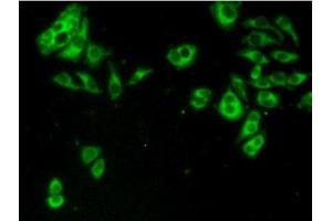 Detection of TACR2 in Hela cells using Polyclonal Antibody to Tachykinin Receptor 2 (TACR2)