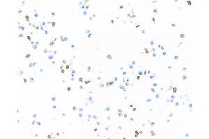 Immunocytochemistry (ICC) image for anti-Mannose Receptor, C Type 1 (MRC1) (AA 1406-1456) antibody (ABIN7455101)