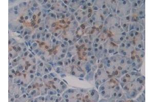 Detection of GR in Human Pancreas Tissue using Polyclonal Antibody to Glutathione Reductase (GR)