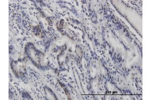 Immunohistochemistry (IHC) image for anti-Tumor Protein P53 (TP53) (pSer315) antibody (ABIN3201006) (p53 anticorps  (pSer315))