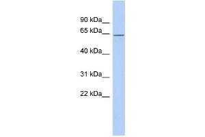 WB Suggested Anti-RNPC3 Antibody Titration:  0. (RNP anticorps  (Middle Region))