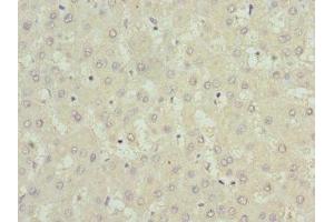 Immunohistochemistry of paraffin-embedded human liver tissue using ABIN7174262 at dilution of 1:100 (USP15 anticorps  (C-Term))