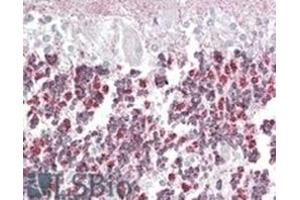 Image no. 2 for anti-Epilepsy, Progressive Myoclonus Type 2A, Lafora Disease (Laforin) (EPM2A) (Internal Region), (Isoform A) antibody (ABIN375087) (EPM2A anticorps  (Internal Region, Isoform A))