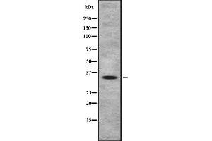 Western blot analysis OR4A47 using HeLa whole cell lysates (OR4A47 anticorps  (Internal Region))