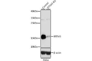 Western blot analysis of extracts from normal (control) and IFITM3 knockout (KO) HeLa cells, using IFITM3 antibody (ABIN6130482, ABIN6142186, ABIN6142187 and ABIN7101416) at 1:3000 dilution.