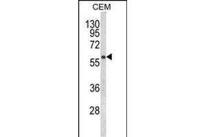 Western blot analysis of FLCN Antibody (Center) (ABIN652602 and ABIN2842404) in CEM cell line lysates (35 μg/lane). (FLCN anticorps  (AA 325-354))