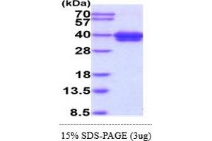 SDS-PAGE (SDS) image for Surfactant Protein D (SFTPD) (AA 22-375) protein (His tag) (ABIN6388178) (SFTPD Protein (AA 22-375) (His tag))