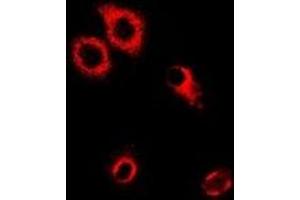 Immunofluorescent analysis of SerRS staining in MCF7 cells. (Seryl-tRNA Synthetase (SARS) anticorps)