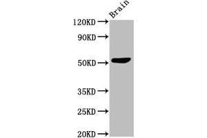 Western Blot Positive WB detected in: Mouse brain tissue All lanes: SLC30A10 antibody at 3 μg/mL Secondary Goat polyclonal to rabbit IgG at 1/50000 dilution Predicted band size: 53, 27, 25 kDa Observed band size: 53 kDa (SLC3A1 anticorps  (AA 58-278))