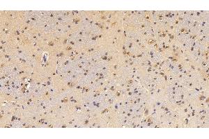 Detection of CYP1A1 in Rat Cerebrum Tissue using Polyclonal Antibody to Cytochrome P450 1A1 (CYP1A1)