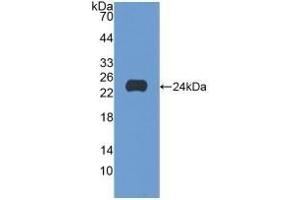 Detection of Recombinant SCFR, Human using Polyclonal Antibody to Stem Cell Factor Receptor (SCFR)