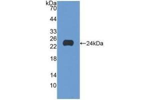 Detection of Recombinant SCFR, Human using Polyclonal Antibody to Stem Cell Factor Receptor (SCFR) (KIT anticorps  (AA 321-520))