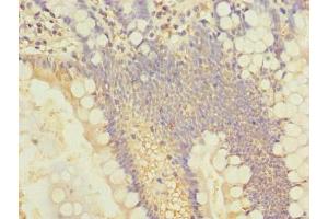 Immunohistochemistry of paraffin-embedded human small intestine tissue using ABIN7143534 at dilution of 1:100 (SLC25A4 anticorps  (AA 40-74))