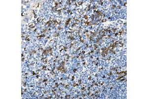 IHC analysis of CD38 using anti-CD38 antibody (ABIN7602815). (CD38 anticorps  (C-Term))