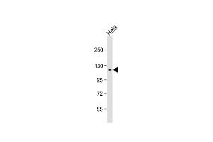 Anti-SNX13 Antibody (C-term) at 1:1000 dilution + Hela whole cell lysate Lysates/proteins at 20 μg per lane. (SNX13 anticorps  (C-Term))