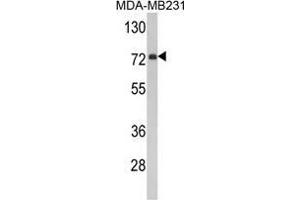 Western blot analysis of FMO3 Antibody (N-term) in MDA-MB231 cell line lysates (35 µg/lane). (FMO3 anticorps  (N-Term))