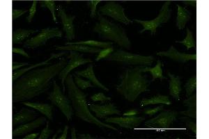 Immunofluorescence of monoclonal antibody to ERCC2 on HeLa cell.