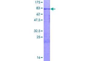 Image no. 1 for Microspherule Protein 1 (MCRS1) (AA 1-462) protein (GST tag) (ABIN1310575)