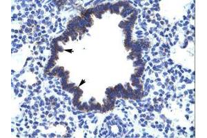 anti-Carbohydrate (N-Acetylglucosamine 6-O) Sulfotransferase 4 (CHST4) (AA 156-205) antibody