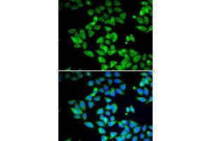 Immunofluorescence analysis of U2OS cells using MAP1LC3B antibody. (LC3B anticorps)