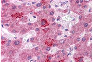 Human Liver: Formalin-Fixed, Paraffin-Embedded (FFPE)