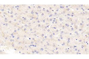 Detection of TSLP in Human Liver Tissue using Polyclonal Antibody to Thymic Stromal Lymphopoietin (TSLP)