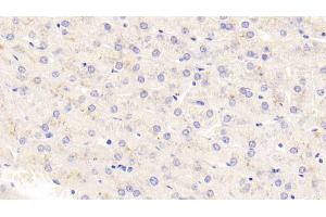 Detection of TSLP in Human Liver Tissue using Polyclonal Antibody to Thymic Stromal Lymphopoietin (TSLP) (Thymic Stromal Lymphopoietin anticorps  (AA 29-159))