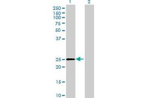 Western Blot analysis of DHRS4L2 expression in transfected 293T cell line by DHRS4L2 MaxPab polyclonal antibody. (DHRS4L2 anticorps  (AA 1-230))