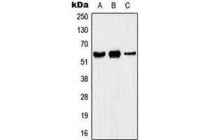 Western blot analysis of Kv1. (KCNA5 anticorps  (Center))