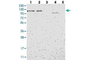 Western blot analysis of Lane 1: RT-4, Lane 2: U-251 MG, Lane 3: Human Plasma, Lane 4: Liver, Lane 5: Tonsil with B4GALNT3 polyclonal antibody . (B4GALNT3 anticorps)