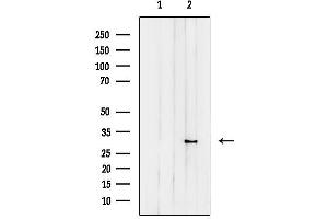 Western blot analysis of lysates from HeLa cells, using CPSF4 Antibody.