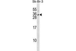 Western blot analysis in SK-BR-3 cell line lysates (35ug/lane) using Interleukin-28B  Antibody (N-term). (IL28B anticorps  (N-Term))
