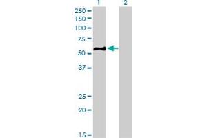 Western Blot analysis of EIF5 expression in transfected 293T cell line by EIF5 monoclonal antibody (M01), clone 2E6-4C12.