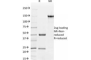 SDS-PAGE Analysis Purified CD31 Mouse Monoclonal Antibody (C31.