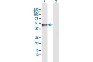 Western Blot analysis of KRT35 expression in transfected 293T cell line by KRT35 MaxPab polyclonal antibody. (Keratin 35 anticorps  (AA 1-455))