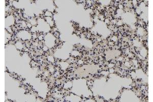 ABIN6273052 at 1/100 staining Mouse lung tissue by IHC-P. (LARP7 anticorps  (C-Term))